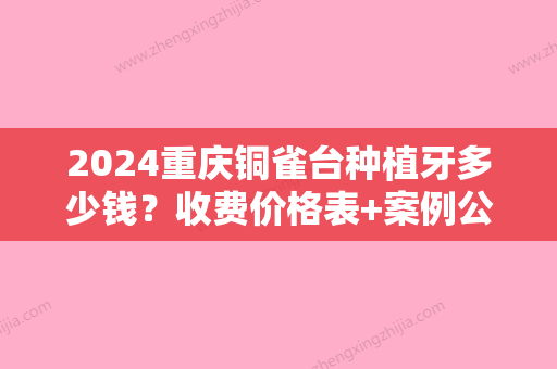 2024重庆铜雀台种植牙多少钱？收费价格表+案例公布