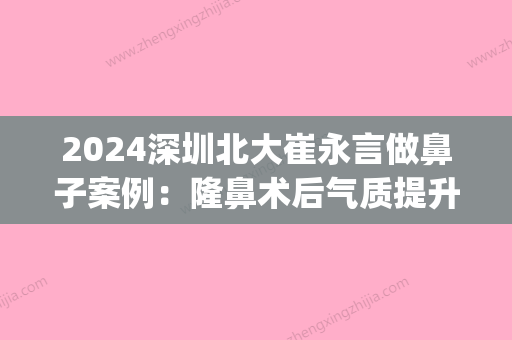 2024深圳北大崔永言做鼻子案例：隆鼻术后气质提升好多~(深圳北大医院隆鼻医生)