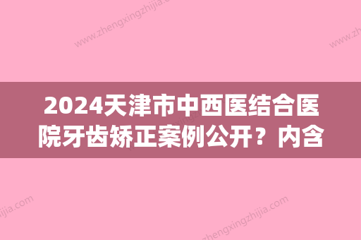 2024天津市中西医结合医院牙齿矫正案例公开？内含真人体验案例(天津牙齿矫正医生)