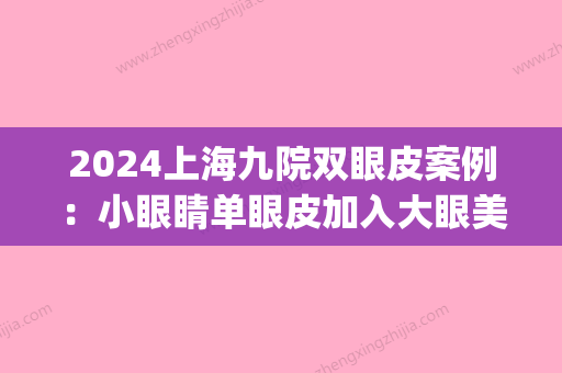 2024上海九院双眼皮案例：小眼睛单眼皮加入大眼美女行列的秘诀！(上海9院双眼皮医生)