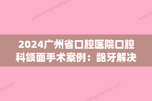 2024广州省口腔医院口腔科颌面手术案例：龅牙解决后	，变成女神！(广东省口腔医院正颌手术医生)