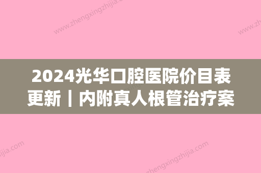 2024光华口腔医院价目表更新｜内附真人根管治疗案例(光华口腔根管治疗大概多少钱)