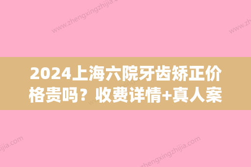 2024上海六院牙齿矫正价格贵吗？收费详情+真人案例公开(上海六院牙齿正畸医生)