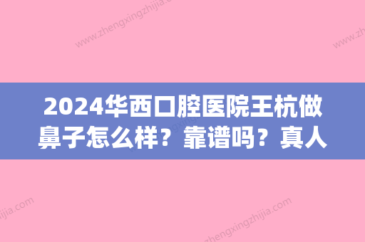 2024华西口腔医院王杭做鼻子怎么样？靠谱吗？真人案例展示(王杭 华西口腔医院)