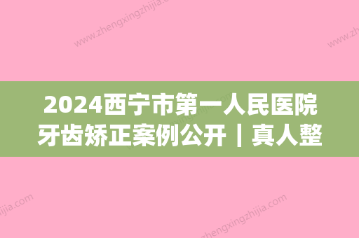 2024西宁市第一人民医院牙齿矫正案例公开｜真人整形日记分享(宁波第一医院矫正牙齿)