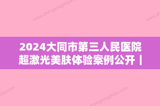 2024大同市第三人民医院超激光美肤体验案例公开｜附真人体验果图