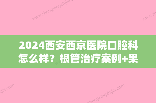 2024西安西京医院口腔科怎么样？根管治疗案例+果图分享(西安交大口腔医院根管治疗)