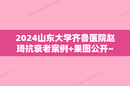 2024山东大学齐鲁医院赵琦抗衰老案例+果图公开~