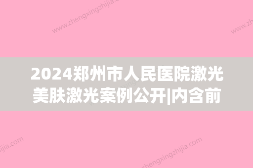 2024郑州市人民医院激光美肤激光案例公开|内含前后变化果图(郑州医院激光祛斑)