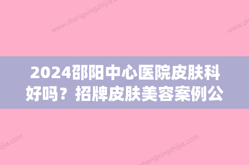 2024邵阳中心医院皮肤科好吗？招牌皮肤美容案例公开(邵东医院看皮肤哪家好?)