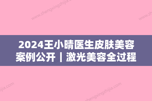 2024王小晴医生皮肤美容案例公开｜激光美容全过程分享