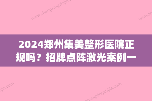 2024郑州集美整形医院正规吗？招牌点阵激光案例一览(郑州集美整形地址医院)