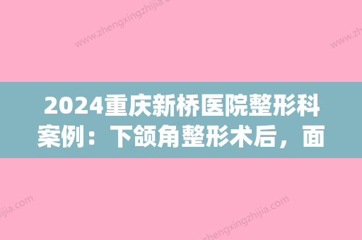 2024重庆新桥医院整形科案例：下颌角整形术后，面部轮廓更精致(重庆新桥医院整形外科)