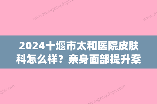 2024十堰市太和医院皮肤科怎么样？亲身面部提升案例分享(十堰太和医院祛斑怎么样)