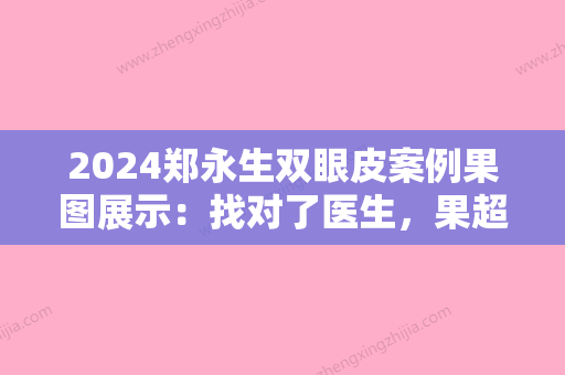 2024郑永生双眼皮案例果图展示：找对了医生，果超棒！