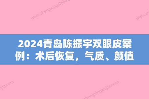 2024青岛陈振宇双眼皮案例：术后恢复，气质、颜值双重提升