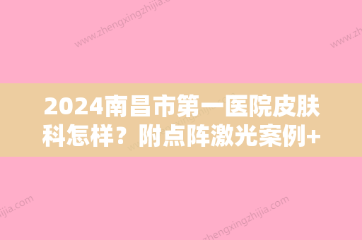 2024南昌市第一医院皮肤科怎样？附点阵激光案例+果图