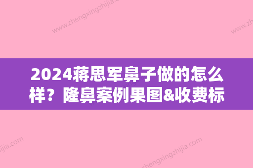 2024蒋思军鼻子做的怎么样？隆鼻案例果图&收费标准展示