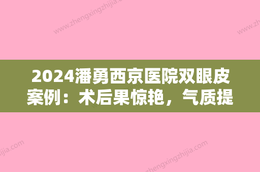 2024潘勇西京医院双眼皮案例：术后果惊艳，气质提升很多！