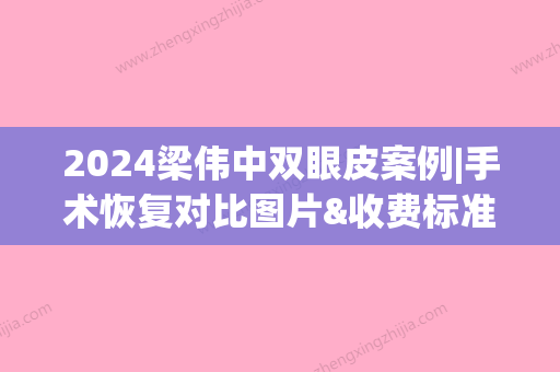 2024梁伟中双眼皮案例|手术恢复对比图片&收费标准展示