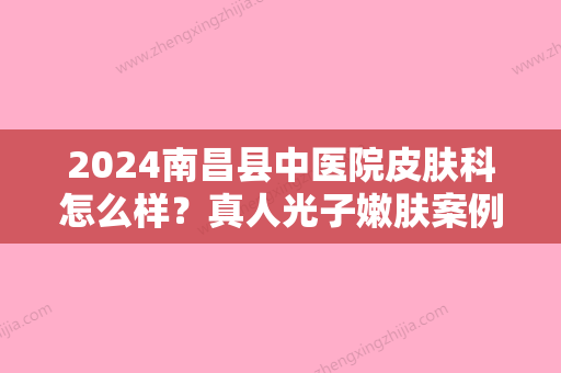 2024南昌县中医院皮肤科怎么样？真人光子嫩肤案例+果图公开