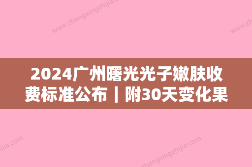 2024广州曙光光子嫩肤收费标准公布｜附30天变化果图