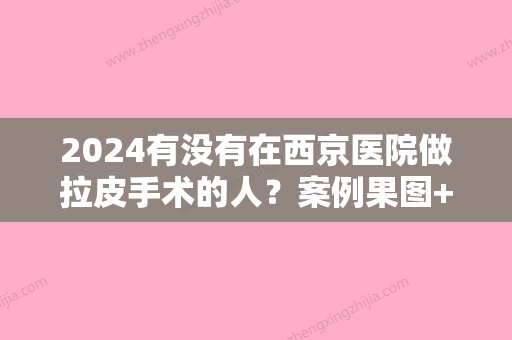 2024有没有在西京医院做拉皮手术的人？案例果图+收费标准