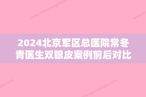 2024北京军区总医院常冬青医生双眼皮案例前后对比图片展示