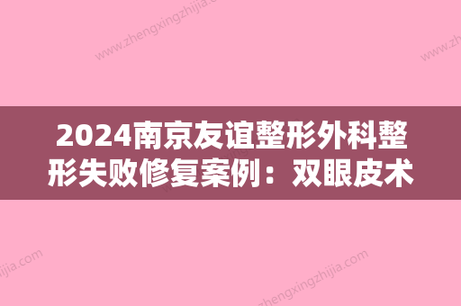 2024南京友谊整形外科整形失败修复案例：双眼皮术后，元气满满