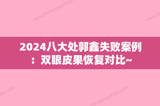 2024八大处郭鑫失败案例：双眼皮果恢复对比~