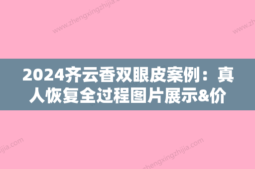 2024齐云香双眼皮案例：真人恢复全过程图片展示&价格表