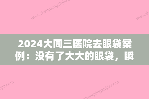 2024大同三医院去眼袋案例：没有了大大的眼袋，瞬间年轻好几岁