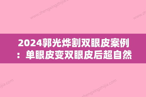 2024郭光烨割双眼皮案例：单眼皮变双眼皮后超自然，自信洋溢