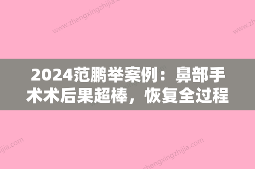 2024范鹏举案例：鼻部手术术后果超棒，恢复全过程展示！