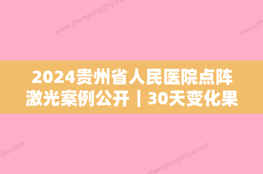 2024贵州省人民医院点阵激光案例公开｜30天变化果图一览