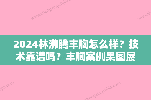 2024林沸腾丰胸怎么样？技术靠谱吗？丰胸案例果图展示