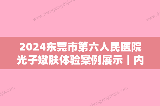 2024东莞市第六人民医院光子嫩肤体验案例展示｜内含恢复果图