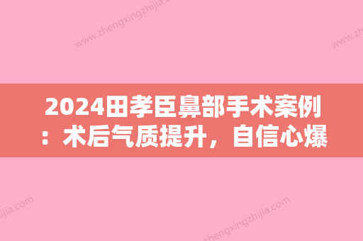 2024田孝臣鼻部手术案例：术后气质提升，自信心爆棚~