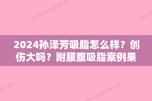 2024孙泽芳吸脂怎么样？创伤大吗？附腰腹吸脂案例果图