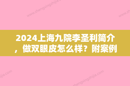 2024上海九院李圣利简介，做双眼皮怎么样？附案例图片