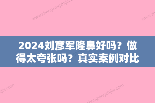 2024刘彦军隆鼻好吗？做得太夸张吗？真实案例对比图