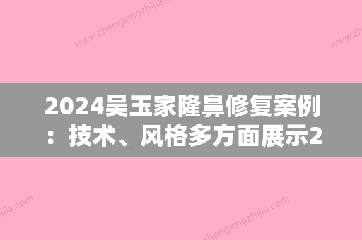 2024吴玉家隆鼻修复案例：技术、风格多方面展示2024