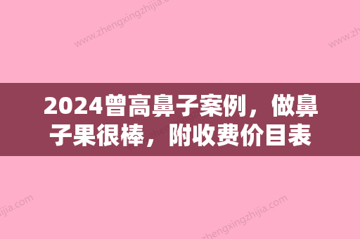 2024曾高鼻子案例，做鼻子果很棒，附收费价目表