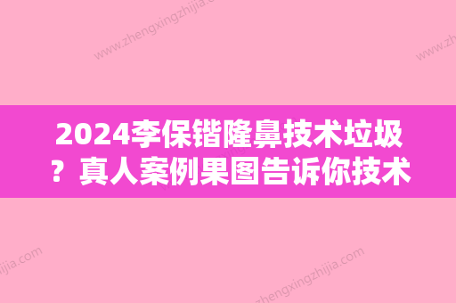 2024李保锴隆鼻技术垃圾？真人案例果图告诉你技术有多好！