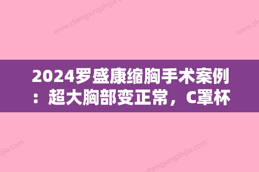 2024罗盛康缩胸手术案例：超大胸部变正常，C罩杯刚好！