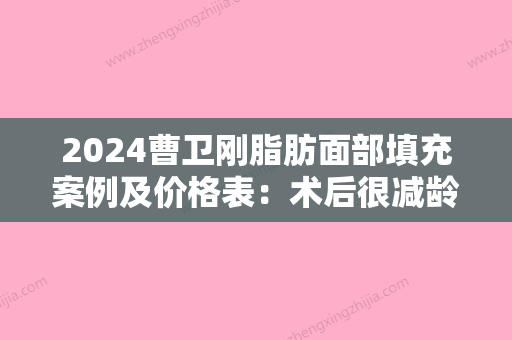 2024曹卫刚脂肪面部填充案例及价格表：术后很减龄~