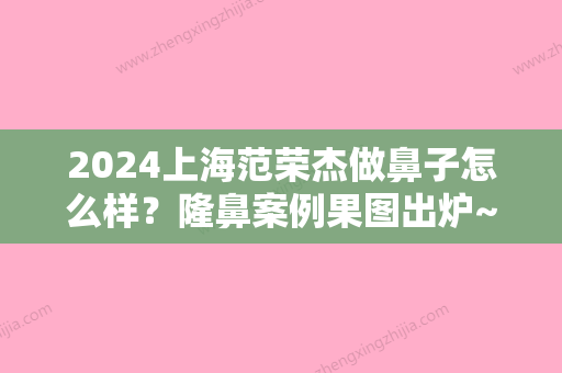 2024上海范荣杰做鼻子怎么样？隆鼻案例果图出炉~