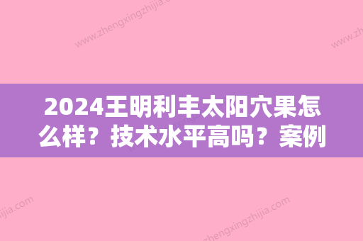 2024王明利丰太阳穴果怎么样？技术水平高吗？案例+价格表