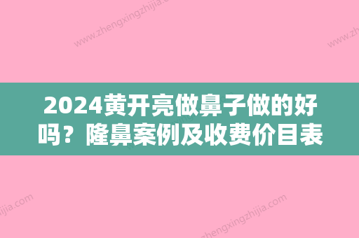 2024黄开亮做鼻子做的好吗？隆鼻案例及收费价目表一览