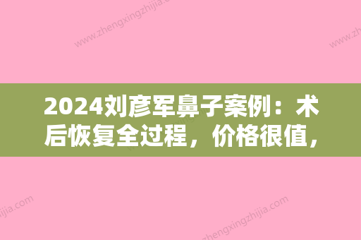 2024刘彦军鼻子案例：术后恢复全过程，价格很值，果好！